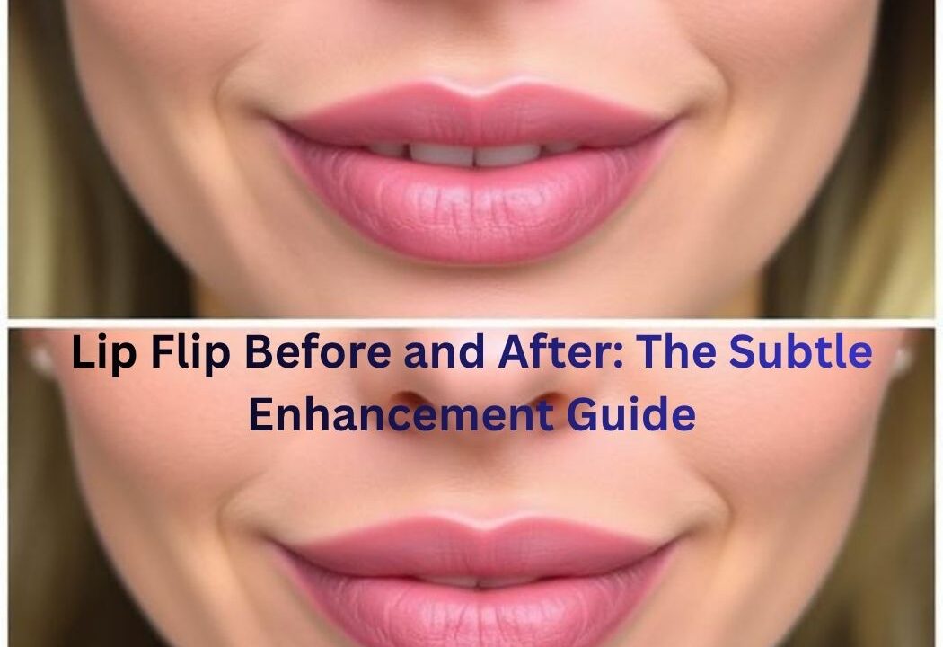Lip Flip Before and After: The Subtle Enhancement Guide